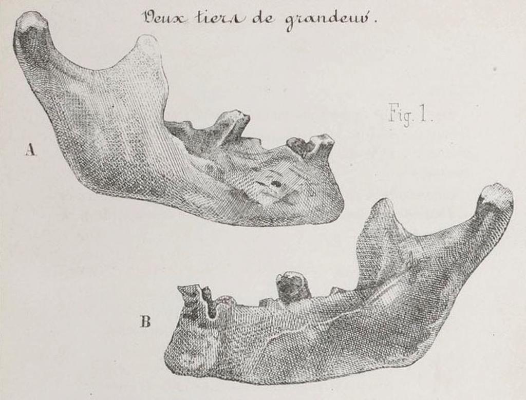 Mâchoire (hémi-mandibule). Découverte en 1863 dans la carrière de Moulin-Quignon à Abbeville (Somme). Époque médiévale ou moderne (XIIIe-XVIIIe siècle). L. 11,5 cm. Inv. MNHN 2976, d’après Boucherde Perthes, Antiquités celtiques et antédiluviennes, t. 3, pl. III. 