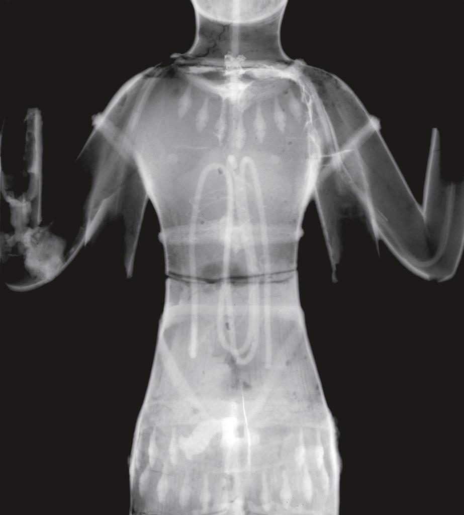 Radiographie à rayons X du buste d’un Vishnu. Provenance exacte inconnue. Fin du XIᵉ siècle. Bronze, H. 87 cm. Paris, musée national des arts asiatiques - Guimet (MA 1339).