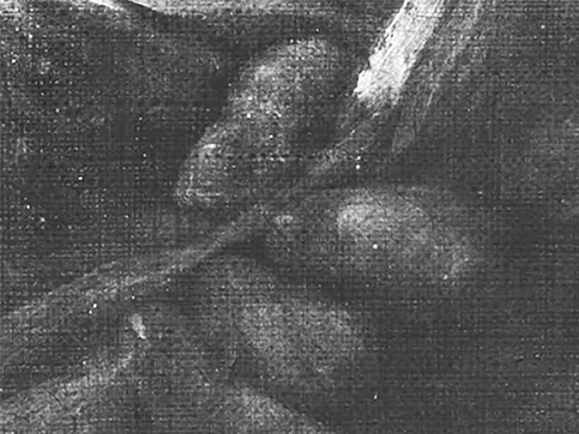 Détail de la main de la servante Abra à la radiographie.