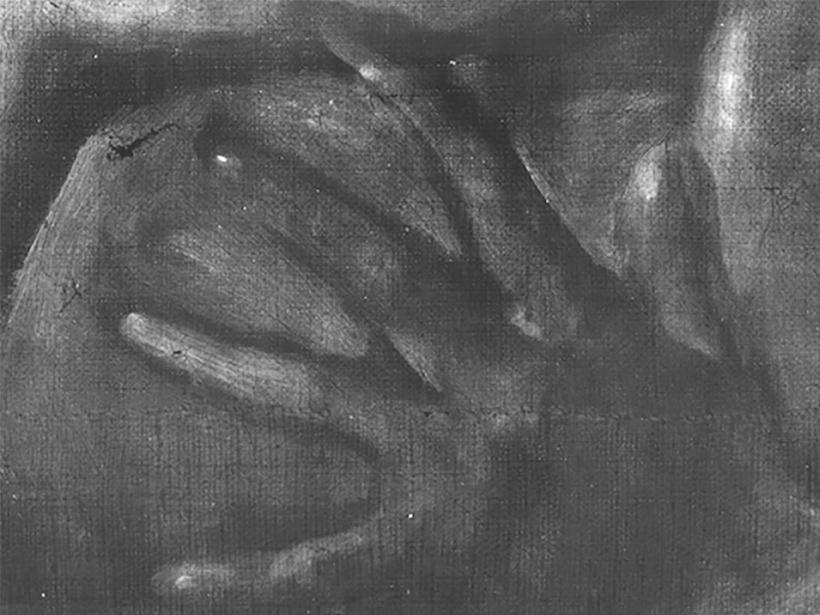 Détail de la main d'Holopherne à la radiographie.